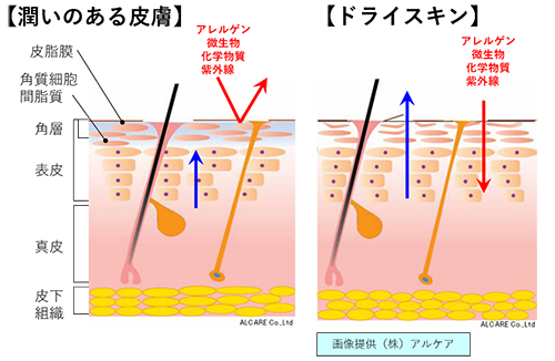 ドライスキンを引き起こすメカニズム