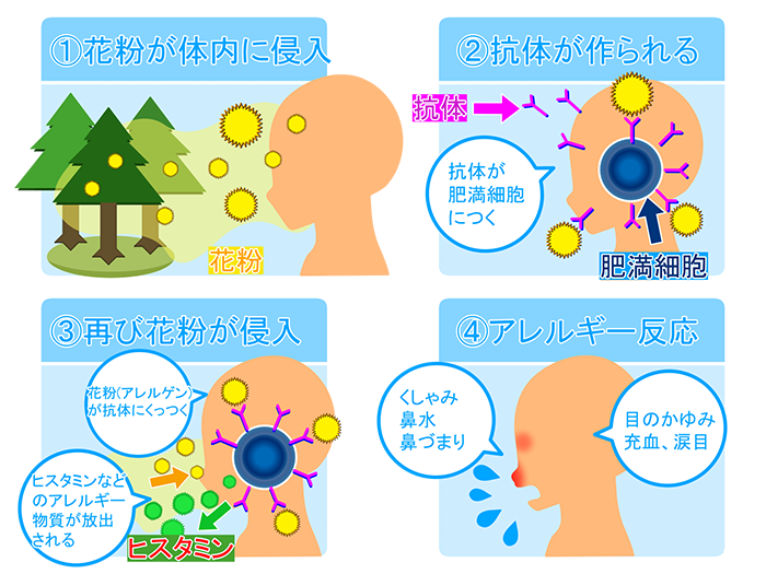 花粉症のメカニズム