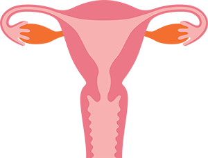 子宮の癌（がん）にも腹腔鏡手術