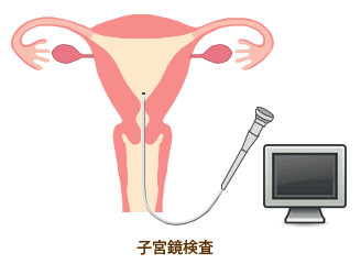 人体骨図