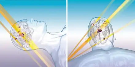 ハイパーアークイメージ