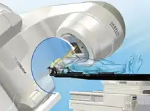 トゥルービーム・ハイパーアーク