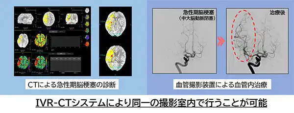 IVRシステムについて