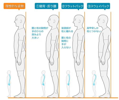 簡単な姿勢チェックをしてみましょう