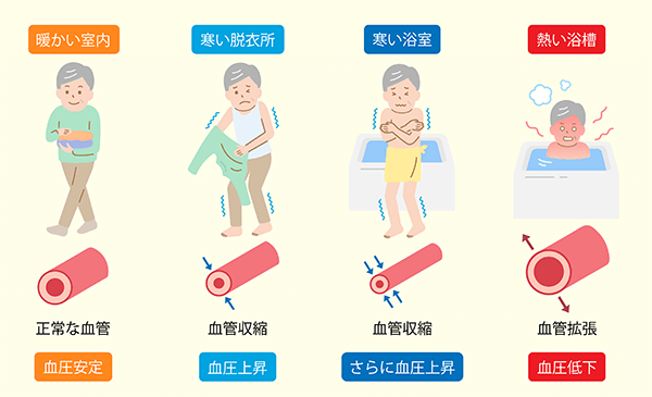 ヒートショックはなぜ起きるのか?