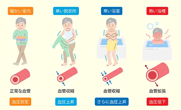 ヒートショックはなぜ起きるのか？