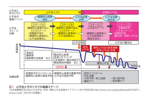 心不全とそのリスクの進展ステージ