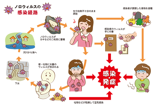 ノロウイルスについて ドクターコラム 新百合ヶ丘総合病院