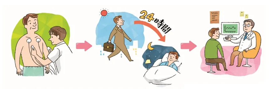 ホルター心電図