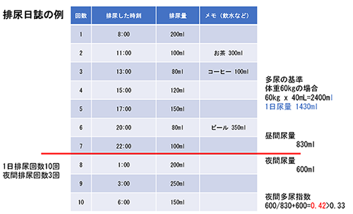 排尿日誌の例