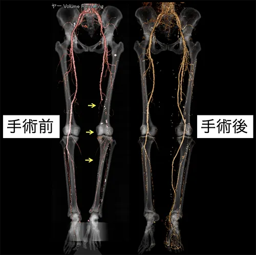 図2. CT検査