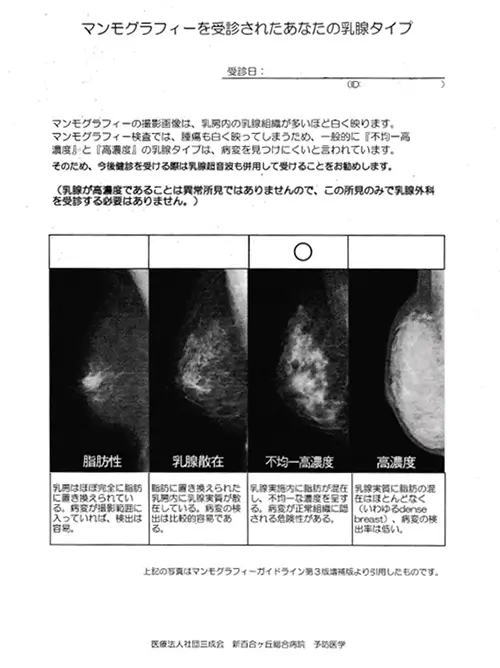 図2　乳腺の濃さ　～マンモグラフィを受診されたあなたの乳腺タイプ～