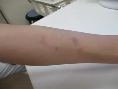 「原因不明のあざ」から見えてくる医学界の分岐点《前編》