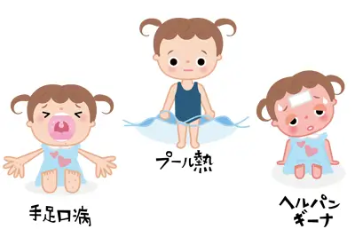 夏風邪イメージ