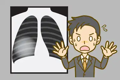 肺癌疑いで驚いているイメージ