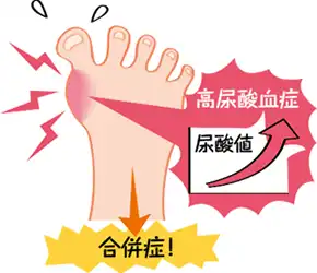 壊疽イメージ