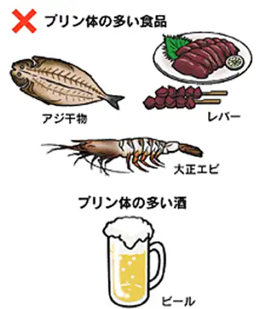 脳梗塞イメージ