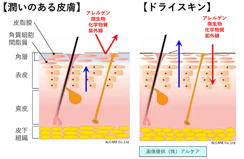 ドライスキンを引き起こすメカニズム