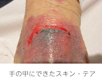 あなたの皮膚は大丈夫ですか・・？