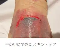 あなたの皮膚は大丈夫ですか・・?