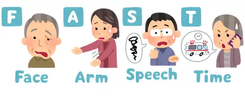 FAST(ファスト)について