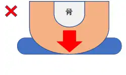 図③ へたりが強いと底付きし圧が集中する