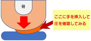 図⑤　介助者の手で圧を確認する