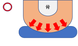 図①　骨突出部の凹凸の圧を分散します