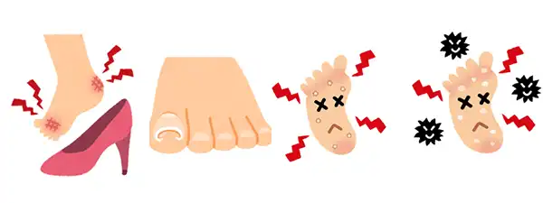 フットケアで大切なことは、足をよく見ることです