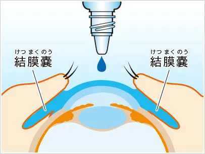 点眼薬のさし方について