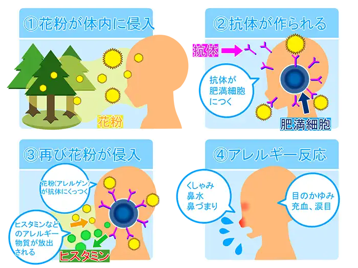 花粉症のメカニズム