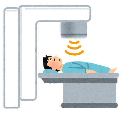 がんの放射線治療