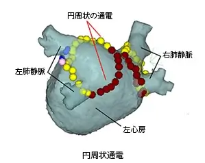 円周状通電イラスト