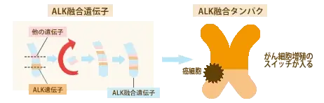 ALK 融合遺伝子