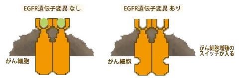EGFR遺伝子変異