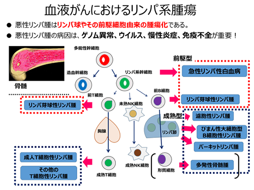 悪性リンパ腫 血液内科 新百合ヶ丘総合病院