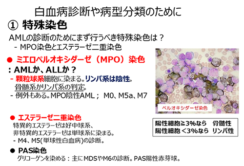 白血病診断や病型分類のために ①特殊染色