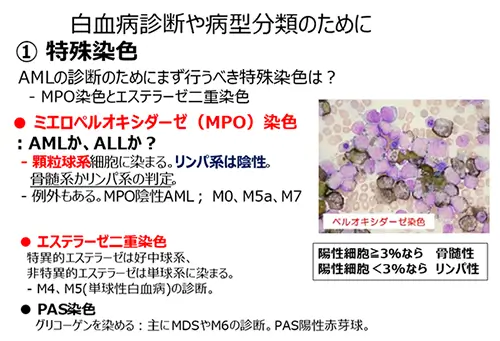 白血病診断や病型分類のために ①特殊染色