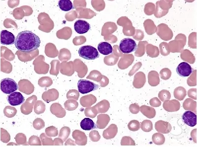 CLLの見通しはどうなりますか?