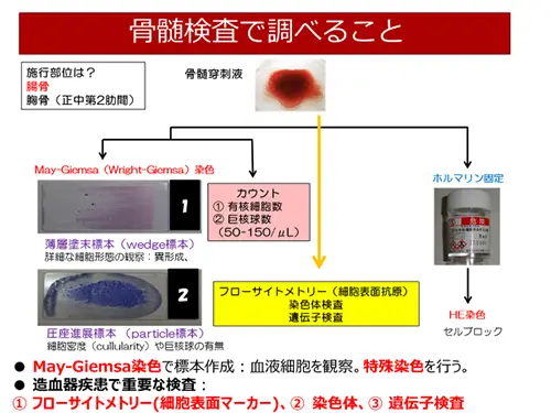 骨髄検査で調べること