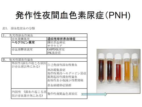 発作性夜間血色素尿症とは