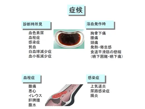 発作性夜間血色素尿症の症状