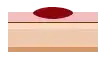 ステージ0