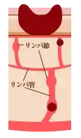 ステージ3