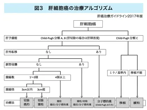 肝細胞癌の治療アルゴリズム