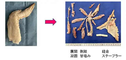 ダヴィンチxiを用いたロボット手術風景