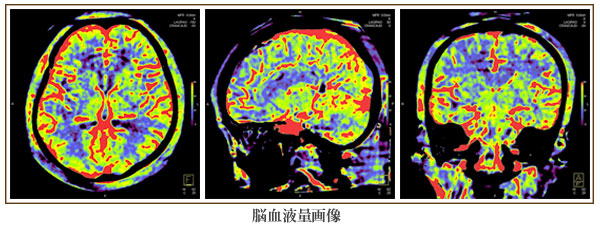 脳血液量画像