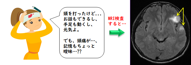 頭部外傷は侮ることなかれ