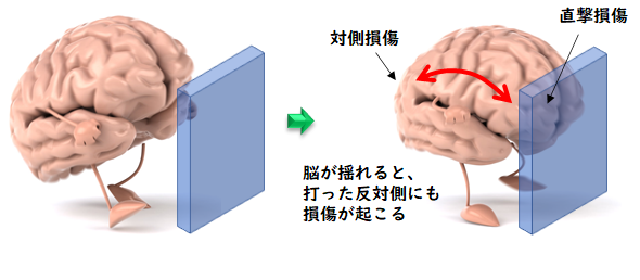 頭部外傷について 対象疾患 脳神経外科 新百合ヶ丘総合病院