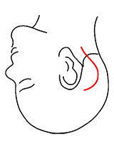 「耳の後ろの乳様突起を削って頭蓋底にアプローチする手術」で用いる皮膚切開